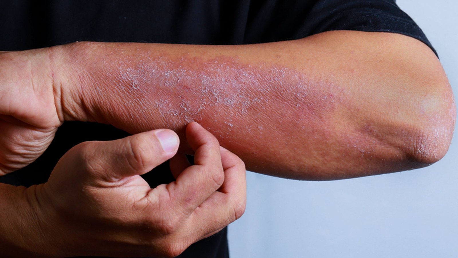 Can You Get High from Cat Pee?