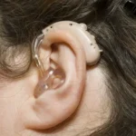 Hearing Aids in Lahore and Digital Hearing Aid Price