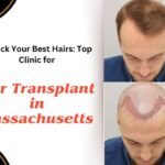 Unlock-Your-Best-Hairs-Top-Clinic-for-Hair-Transplant-in-Massachusetts