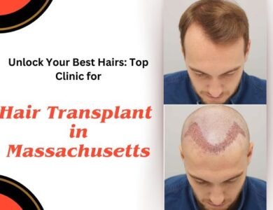 Unlock-Your-Best-Hairs-Top-Clinic-for-Hair-Transplant-in-Massachusetts