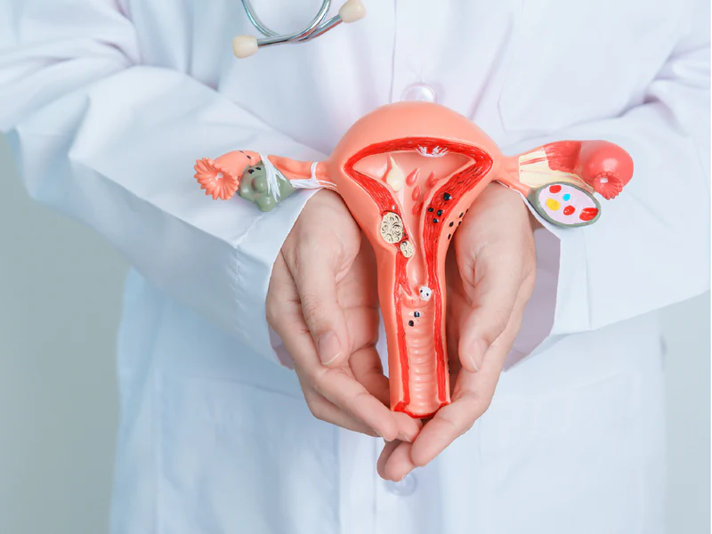 Empowering Patients: Support Resources for Prolapsed Uterus and Prostate Cancer